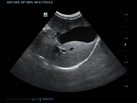 may sieu am thu y mindray m7vet canine gall bladder